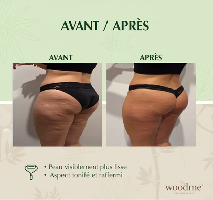 Woodme - Kit de maderoterapia